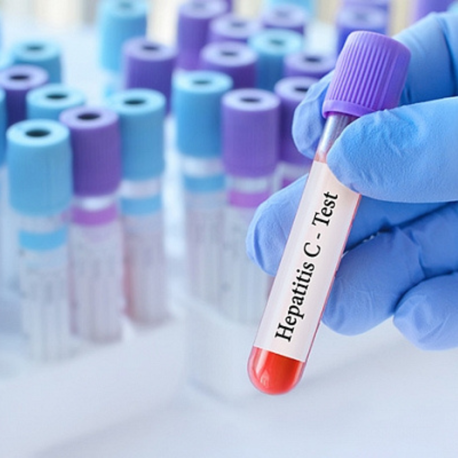 <p>Kampaņā 197 iedzīvotājiem atklāts pozitīvs C hepatīta tests</p>