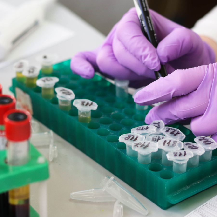 <p>Bez maksas varēs nodot C hepatīta analīzes</p>