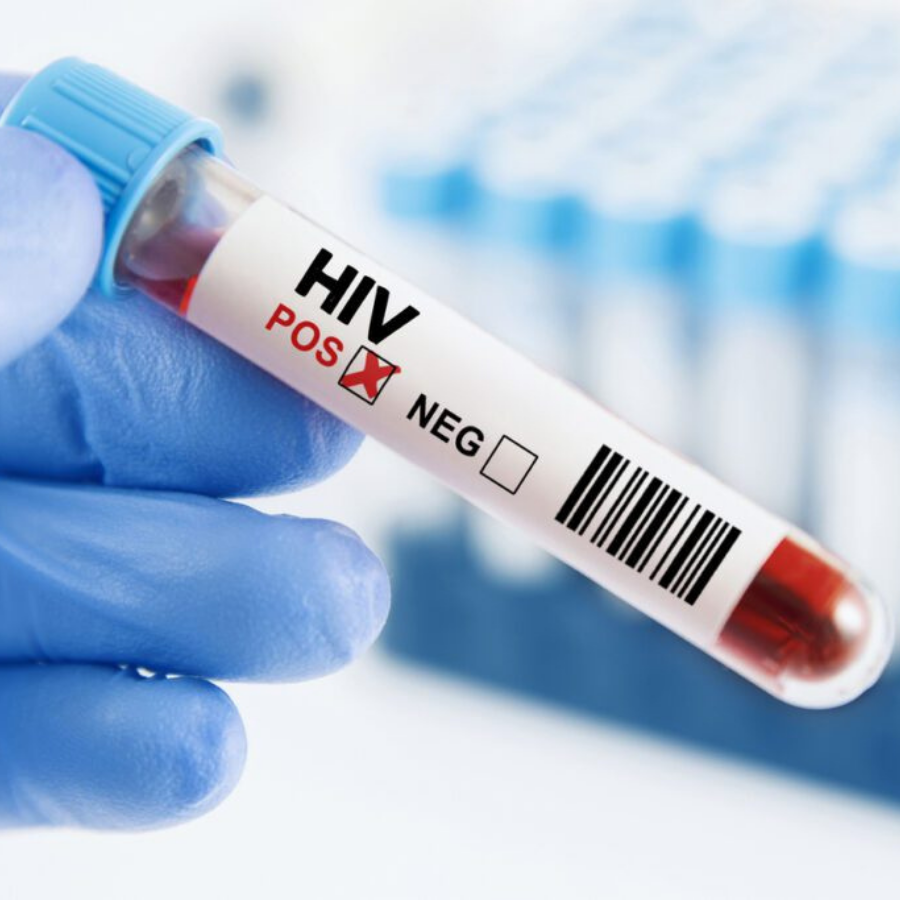 <p>HIV profilakses punktos pērn veikti gandrīz 6000 HIV eksprestestu</p>