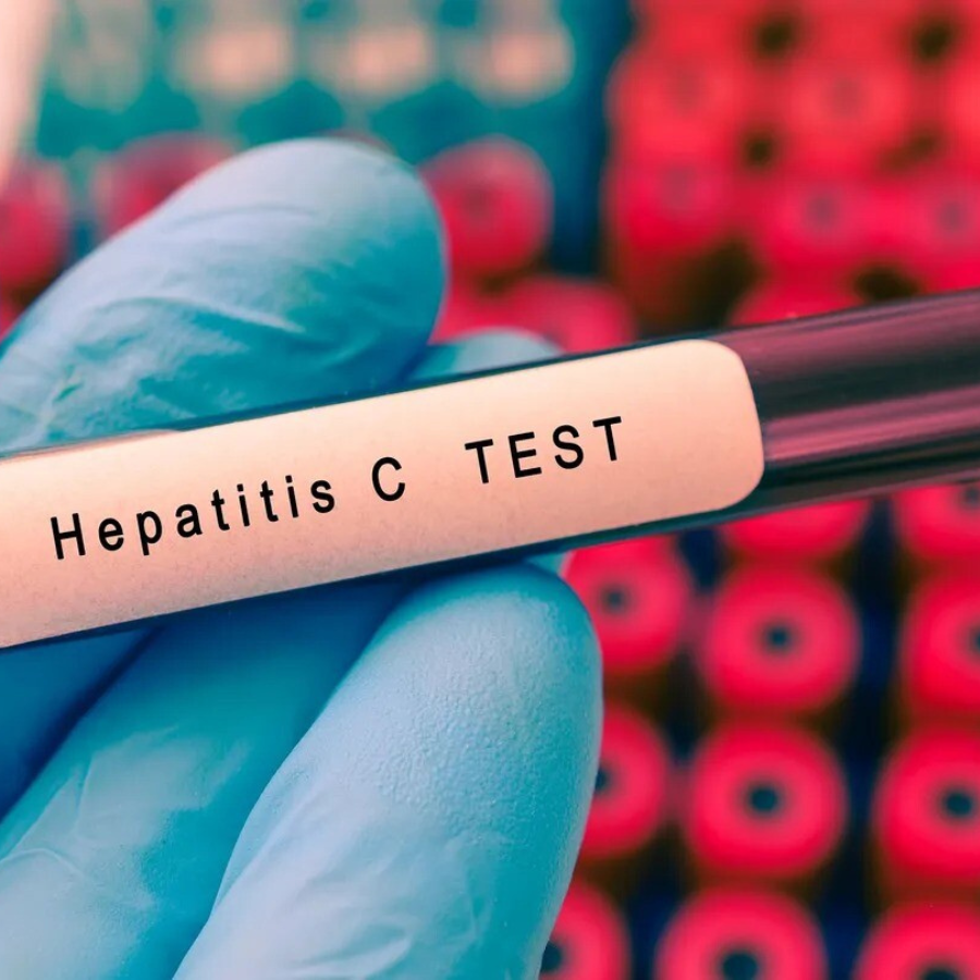 <p>Austrumu slimnīca piedāvā bezmaksas C hepatīta un HIV testus Eiropas testē&scaron;anas nedēļā</p>